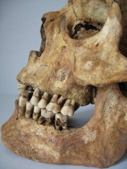Rotherham skull with overbite